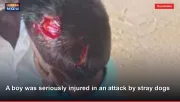 A boy was seriously injured in an attack by stray dogs