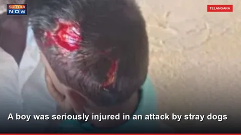 A boy was seriously injured in an attack by stray dogs